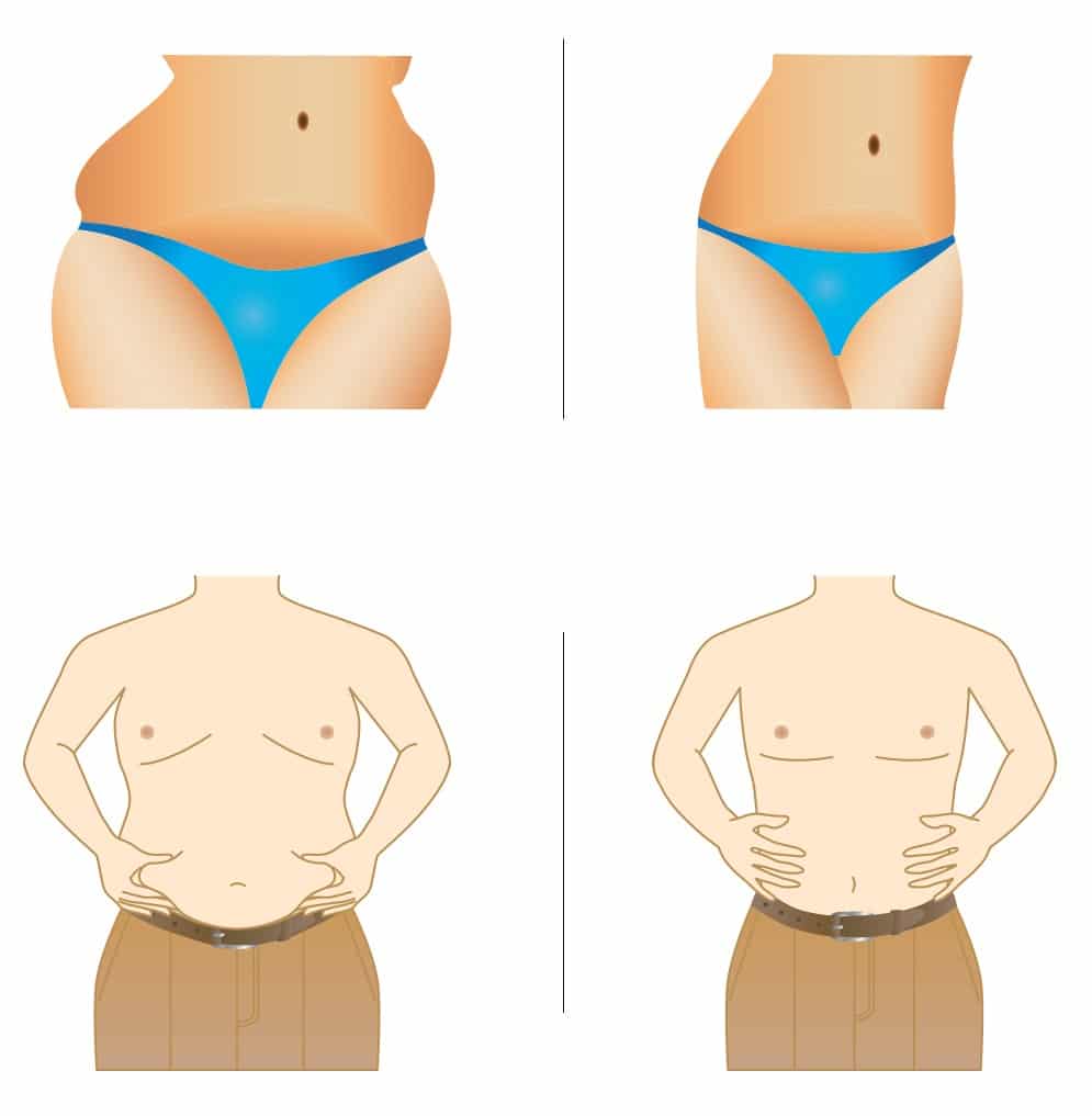 Mesotherapy - Slimming & Cellulite Reduction