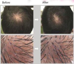 Nashi-Italia] Combo Dầu gội xả tái tạo dành cho tóc khô và hư tổn Nashi Filler  Therapy 250ml/150ml ( chính hãng ) | Lazada.vn